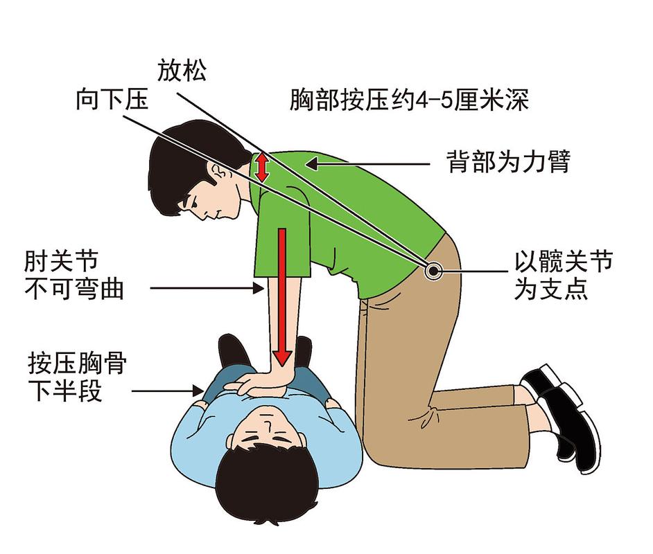 心肺复苏(心肺复苏的有效指征)