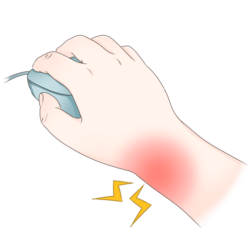 鼠标手职业病\(鼠标手职业病 新华社图片)