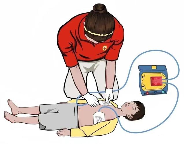 心肺复苏黄金4分钟（心肺复苏黄金4分钟图片）